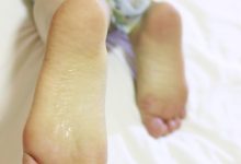 鱼鱼足影 NO.046 - 粥粥[181P+1V／972MB]-套图岛